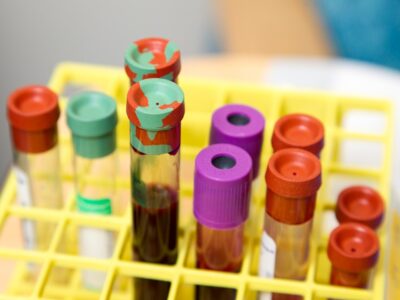 Blood test tubes in a medical laboratory representing understanding blood test results